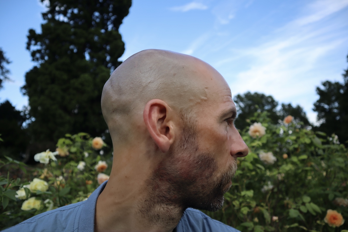 Jake in profile in a rose garden wearing a light blue jacket